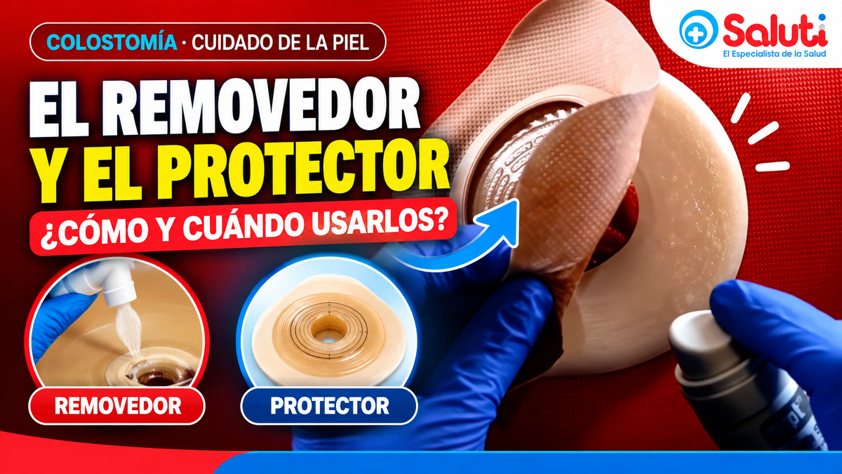 Protector de piel y removedor de adhesivo: cambio de barrera de colostomía paso a paso