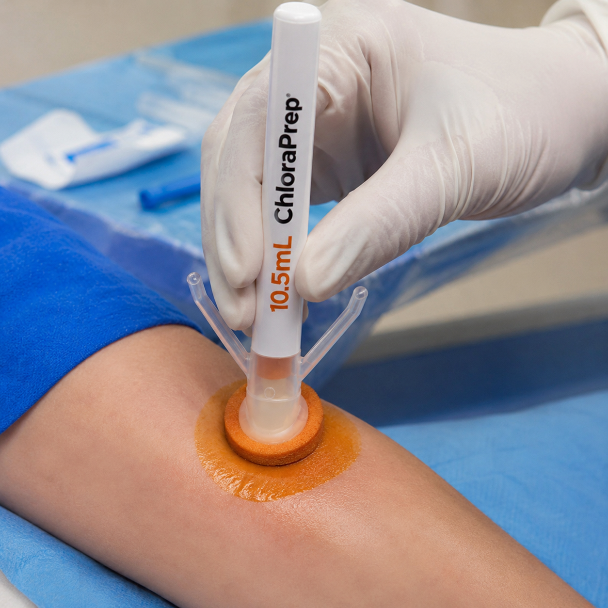 Aplicador Chloraprep 10.5 ml BD en uso durante procedimiento clínico, aplicando solución antiséptica de clorhexidina 2% con alcohol 70% sobre la piel para preparación y antisepsia previa al procedimiento médico