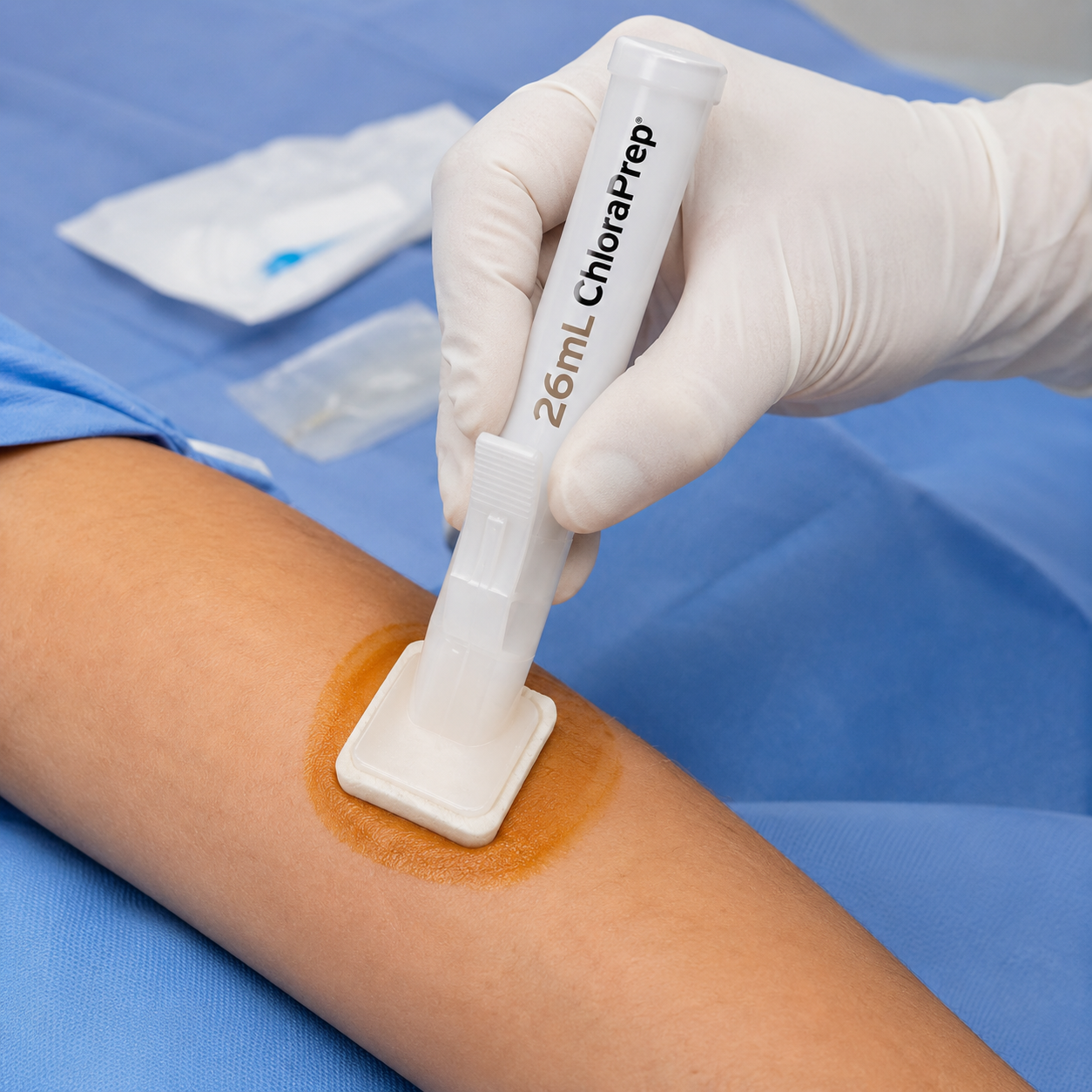 Aplicador Chloraprep 26 ml BD en uso durante procedimiento clínico, aplicando solución antiséptica de clorhexidina 2% con alcohol 70% sobre la piel para preparación y antisepsia previa al procedimiento médico.